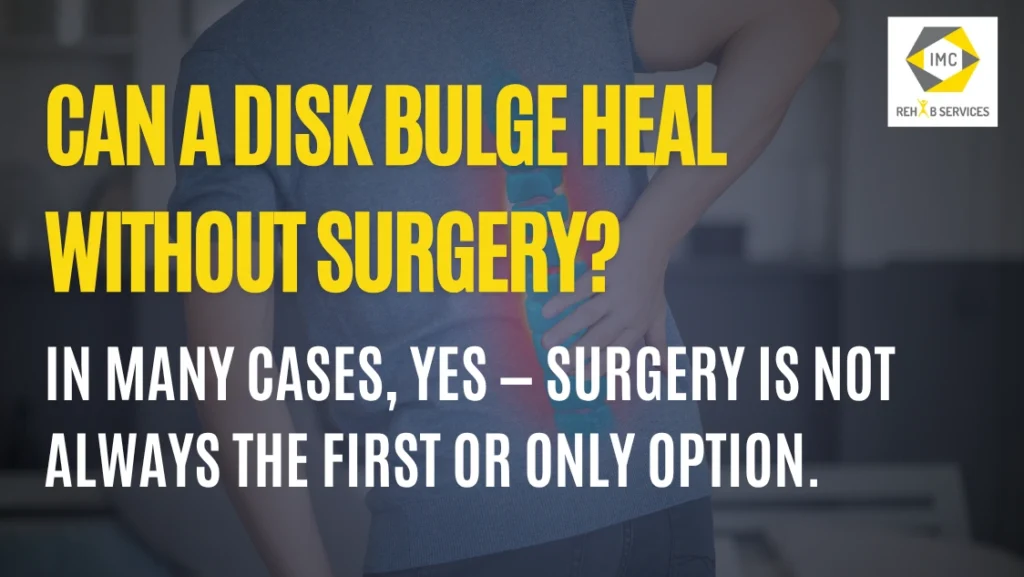 graphic view of disc bulge